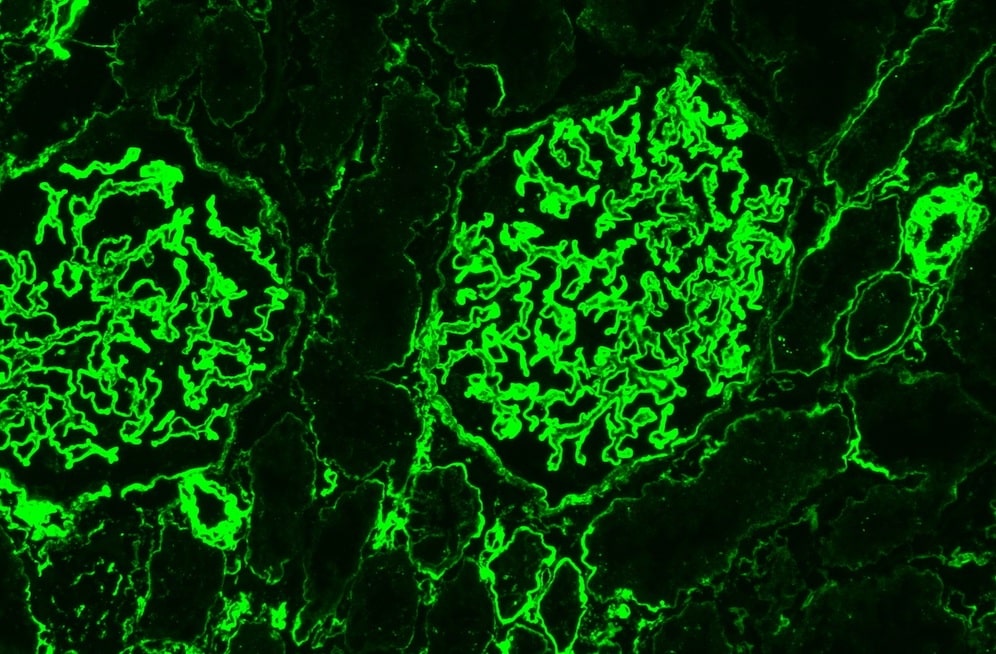 heparan-sulfate-products-covid19-infection-disease-amp