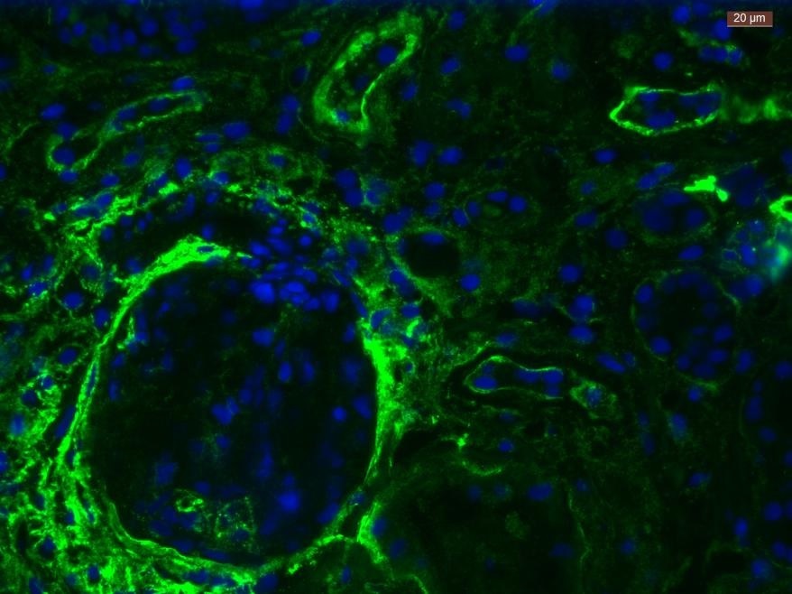 new-biotinylated-10e4-heparan-sulfate-antibodies