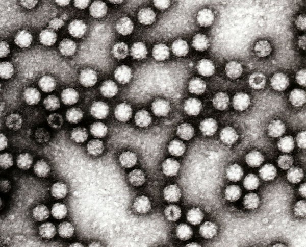 Astrovirus