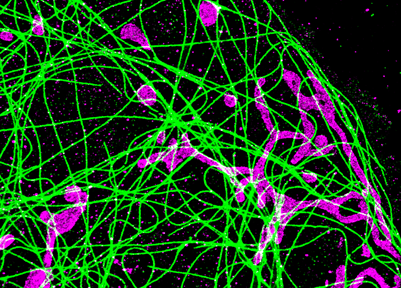 biotium-announces-optimized-antibody-labeling-kits